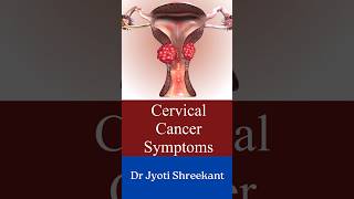 Cervical cancer symptoms shorts [upl. by Samantha823]