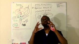 Primary Biliary cirrhosis Lecture [upl. by Godwin628]