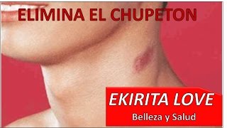 ELIMINA CHUPETON CHUPETE SUGILACION  Ekirita Love [upl. by Haraf854]