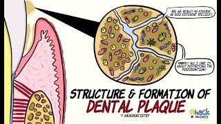 Dental Plaque Structure and Formation [upl. by Ecile]