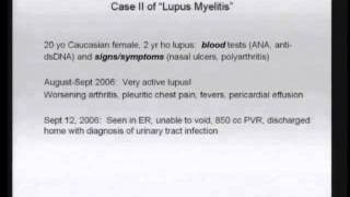 Neurological manifestations of lupus and other systemic rheumatologic disorders [upl. by Englebert886]