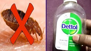 How To Get Rid Of Bed Bugs Guaranteed 4 Easy Steps [upl. by Lee]