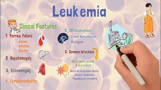 Leukemia  Causes  Types  Early signs amp Treatment [upl. by Portuna]