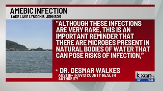 Person gets sick dies from amebic infection after swimming in Lake Lyndon B Johnson [upl. by Verbenia518]