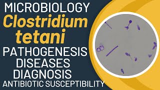 Clostridium tetani pathogenesis  Clostridium tetani microbiology  lab diagnosis treatment [upl. by Namad]