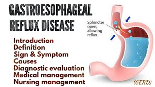 Gastroesophageal Reflux Disease GERD  Explained in hindi [upl. by Anikehs103]