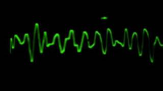 EKG Fibrilación Ventricular [upl. by Elam]