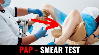 Pap  smear test [upl. by Godard]