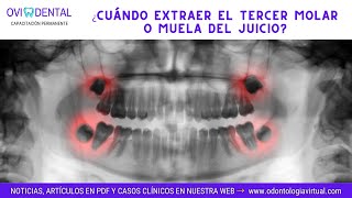 ► PERICORONARITIS ¿Cuándo extraer el tercer molar o muela del juicio [upl. by Noleta]