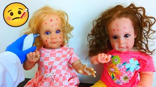 Reborn Sisters Get Chicken Pox Role play [upl. by Kramlich443]