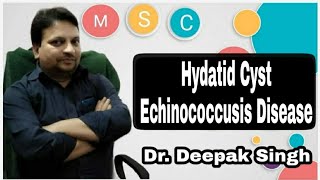 👉 Hydatid Cyst  Hydatid Diseases  Parasitic Cyst  Echinococcusis Disease  Dr Deepak Singh  MSC [upl. by Waltner]