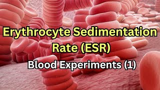 Erythrocyte Sedimentation Rate ESR  Blood experiments 1 [upl. by Eiblehs462]