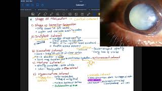 senile cortical cataract  Stage of maturation of senile cortical cataract amp Nuclear cataract [upl. by Ghiselin]