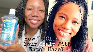 How To Clean Your Scalp With Witch Hazel  Microlocs  Fine Hair  AskDeAvilaSade [upl. by Cadell]