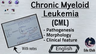 Chronic myeloid leukemia  CML  Pathology In English [upl. by Perren]