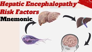 Hepatic Encephalopathy Risk factors Mnemonic [upl. by Amalie]