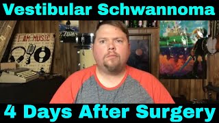 Vestibular Schwannoma 4 Days After Surgery  January 23 2018 [upl. by Gerik]