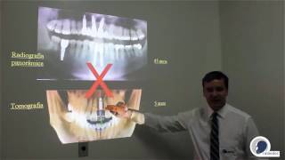 Radiografia Panorâmica x Tomografia  Radiodoc [upl. by Ahseenal]