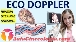 ECO DOPPLER EN OBSTETRICIA HIPOXIA ARTERIAS UTERINAS ANEMIA FETAL  Ginecología y Obstetricia [upl. by Eannyl]