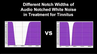 Notched Audio White Noise Sampler of Different Notch Widths in the Treatment for Tinnitus [upl. by Asilak]