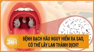 Bệnh bạch hầu Nguồn lây nhiễm và những biến chứng nguy hiểm  Toàn cảnh 24h [upl. by Ateekahs]