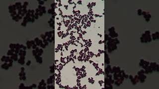 Gram Staining Insights Identifying Staphylococcus hominis as GPC in Singles Pairs and Clusters [upl. by Ainotal]