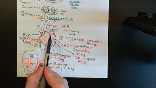 Coronary Artery Disease Part 2 [upl. by Hunsinger250]