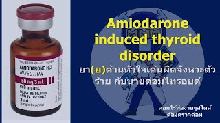 Amiodarone induced thyroid disorders [upl. by Eedyaj]