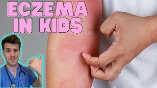 Everything you need to know about Eczema in kids Causes symptoms treatment amp home management [upl. by Helyn]