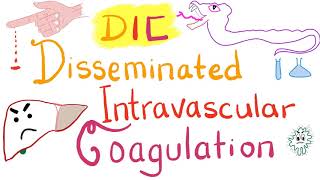 Disseminated Intravascular Coagulation DIC [upl. by Anitsim]