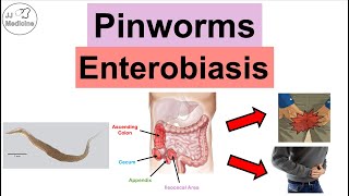 Pinworms Enterobiasis  Infection Transmission Symptoms Diagnosis Treatment [upl. by Naitsabes]