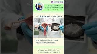 Diagnosis amp treatment of uterine fibroid doctor [upl. by Anilave]