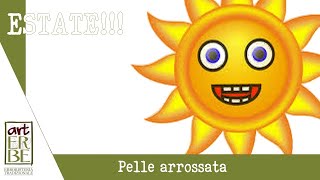 Pelle arrossata Scottature [upl. by Lissi372]