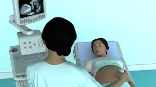 The Basic Steps of an Obstetric Ultrasound Examination [upl. by Gabey]