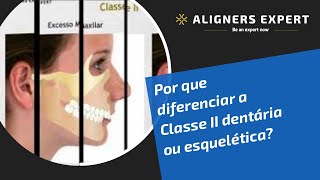 Por que diferenciar a Classe II dentária ou esquelética [upl. by Ibbetson]