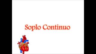 Soplo Continuo [upl. by Elay479]