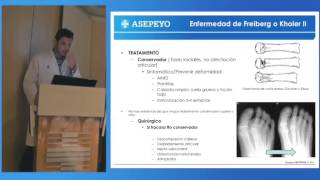 Osteocondritis y osteocondrosis [upl. by Oiliduab]