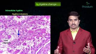 Morphology of Reversible cell injury  General Pathology Animated Lecture Dr Bhanu prakash [upl. by Erda844]