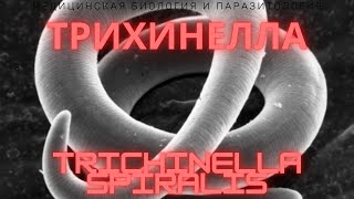 Трихинелла  Trichinella spiralis  Трихинеллез Жизненный Цикл Симптомы Диагностика Профилактика [upl. by Resee886]