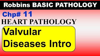 Chp11 Robbins Patho  Heart Pathology  Introduction to Valvular Heart Disease  Dr Asif Lectures [upl. by Esirahc]