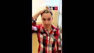 Styling hair 10 months after Hair Transplant  3500 grafts FUE shorts [upl. by Moyers649]