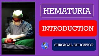 HEMATURIA  INTRODUCTION [upl. by Vinnie643]