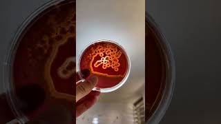 Gram Staining👨‍🔬 Positive Patient Sample After Incubation 48 Hours Growth🦠🔬 lab microbiology [upl. by Nerrej]