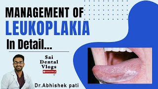 MANAGEMENT OF LEUKOPLAKIA IN DETAIL [upl. by Kitchen]