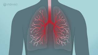 Wat is COPD  Begrijpelijke informatie voor COPD patiënten [upl. by Gilba]