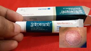 দাউদএকজিমাদাদত্বকের ছত্রাকের চিকিৎসা  Tricoderma Cream Review Bangla  ট্রাইকোডার্মা ক্রীম [upl. by Clementas]