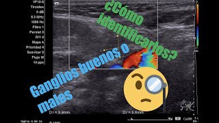 Adenopatías cervicales en niñosDr Daniel Flores [upl. by Thrift]