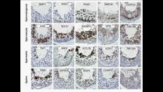 Gene Expression Analysis and Biomarker Discovery Using The Human Protein Atlas [upl. by Smalley852]