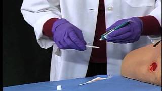 3M™ Tegaderm™ Hydrogel Wound Filler  Application and Removal [upl. by Giddings]