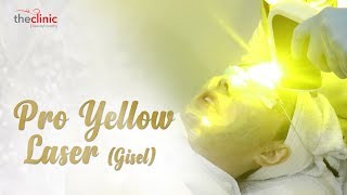 TreatmentTheClinicID  Pro Yellow Laser  Gisella Anastasia [upl. by Elison355]